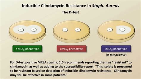 resistant or resistent.